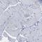 Golgi Membrane Protein 1 antibody, HPA011929, Atlas Antibodies, Immunohistochemistry paraffin image 