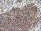 Proteasome subunit alpha type-4 antibody, M06794, Boster Biological Technology, Immunohistochemistry paraffin image 