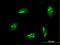 Nucleolar Protein 7 antibody, H00051406-B01P, Novus Biologicals, Immunocytochemistry image 