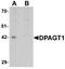 Dolichyl-Phosphate N-Acetylglucosaminephosphotransferase 1 antibody, A08142, Boster Biological Technology, Western Blot image 
