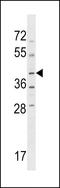 NPR2 Like, GATOR1 Complex Subunit antibody, LS-C162968, Lifespan Biosciences, Western Blot image 