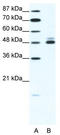 Cholinergic Receptor Nicotinic Beta 2 Subunit antibody, TA330427, Origene, Western Blot image 