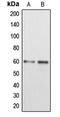 Disabled homolog 1 antibody, LS-C352109, Lifespan Biosciences, Western Blot image 