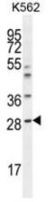 Amyloid P Component, Serum antibody, AP50206PU-N, Origene, Western Blot image 