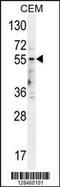 5-Hydroxytryptamine Receptor 3E antibody, 55-244, ProSci, Western Blot image 
