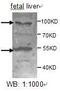 ADAM Metallopeptidase With Thrombospondin Type 1 Motif 8 antibody, MBS416065, MyBioSource, Western Blot image 