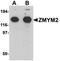 Zinc finger protein 198 antibody, orb75556, Biorbyt, Western Blot image 