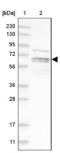 Phosphatidylinositol-4-Phosphate 5-Kinase Type 1 Alpha antibody, NBP1-90358, Novus Biologicals, Western Blot image 