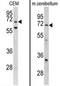 Leucine Rich Repeat Containing 32 antibody, AP17415PU-N, Origene, Western Blot image 