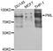 Promyelocytic Leukemia antibody, LS-B13361, Lifespan Biosciences, Western Blot image 