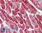Desmin antibody, LS-B2264, Lifespan Biosciences, Immunohistochemistry paraffin image 