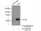 Glucokinase antibody, 15629-1-AP, Proteintech Group, Immunoprecipitation image 