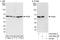Pyruvate Kinase M1/2 antibody, A303-660A, Bethyl Labs, Western Blot image 