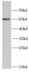 DNA Polymerase Gamma 2, Accessory Subunit antibody, FNab06611, FineTest, Western Blot image 