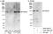 Rho GTPase Activating Protein 29 antibody, A301-924A, Bethyl Labs, Immunoprecipitation image 