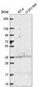 Aldehyde Dehydrogenase 3 Family Member A1 antibody, HPA063783, Atlas Antibodies, Western Blot image 