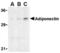 Adiponectin, C1Q And Collagen Domain Containing antibody, TA306228, Origene, Western Blot image 