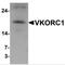 VKOR1 antibody, NBP2-81859, Novus Biologicals, Western Blot image 