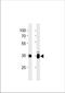 Ubiquitin C-terminal hydrolase UCH37 antibody, TA324998, Origene, Western Blot image 