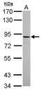 ADAM Metallopeptidase Domain 22 antibody, NBP2-15282, Novus Biologicals, Western Blot image 