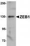Zinc Finger E-Box Binding Homeobox 1 antibody, TA319713, Origene, Western Blot image 