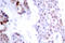ATF4 antibody, AP01533PU-N, Origene, Immunohistochemistry paraffin image 
