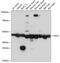 Cysteine desulfurase, mitochondrial antibody, GTX33356, GeneTex, Western Blot image 