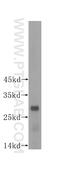 Phosphoglycerate Mutase 1 antibody, 16126-1-AP, Proteintech Group, Western Blot image 