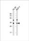 Olfactory Receptor Family 10 Subfamily J Member 5 antibody, PA5-71508, Invitrogen Antibodies, Western Blot image 