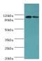 10-FTHFDH antibody, LS-C375187, Lifespan Biosciences, Western Blot image 