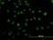 Zinc Finger Protein 207 antibody, H00007756-M06, Novus Biologicals, Immunofluorescence image 