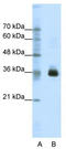 Homeobox protein OTX1 antibody, TA343740, Origene, Western Blot image 
