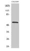Calcium/Calmodulin Dependent Protein Kinase II Gamma antibody, STJ91990, St John