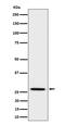 Adiponectin, C1Q And Collagen Domain Containing antibody, M00509-3, Boster Biological Technology, Western Blot image 