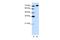 A-Kinase Anchoring Protein 8 Like antibody, PA5-41551, Invitrogen Antibodies, Western Blot image 