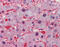 L-lactate dehydrogenase A chain antibody, ARP54776_P050, Aviva Systems Biology, Immunohistochemistry paraffin image 
