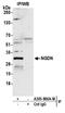 Neuroguidin antibody, A305-866A-M, Bethyl Labs, Immunoprecipitation image 