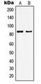 Histone acetyltransferase MYST2 antibody, orb215041, Biorbyt, Western Blot image 