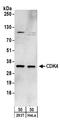 Cyclin Dependent Kinase 4 antibody, A304-224A, Bethyl Labs, Western Blot image 