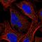 Casein Kinase 1 Gamma 2 antibody, HPA056572, Atlas Antibodies, Immunofluorescence image 
