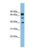 LETM1 Domain Containing 1 antibody, NBP1-59843, Novus Biologicals, Western Blot image 