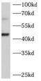 Beta-1,4-Galactosyltransferase 2 antibody, FNab00773, FineTest, Western Blot image 