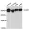 Kinetochore Scaffold 1 antibody, A32138, Boster Biological Technology, Western Blot image 