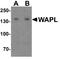 WAPL Cohesin Release Factor antibody, A03684, Boster Biological Technology, Western Blot image 