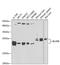Biliverdin Reductase B antibody, 22-819, ProSci, Western Blot image 