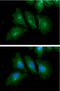 RAB7A, Member RAS Oncogene Family antibody, GTX57709, GeneTex, Immunofluorescence image 