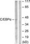 CCAAT/enhancer-binding protein alpha antibody, TA312953, Origene, Western Blot image 