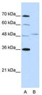 Forkhead Box Q1 antibody, TA345478, Origene, Western Blot image 