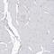 3-Hydroxybutyrate Dehydrogenase 2 antibody, PA5-57501, Invitrogen Antibodies, Immunohistochemistry frozen image 