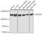 Ubiquitin carboxyl-terminal hydrolase 26 antibody, GTX55837, GeneTex, Western Blot image 